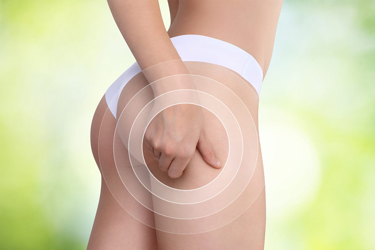 eliminer la cellulite eliminer la cellulite
