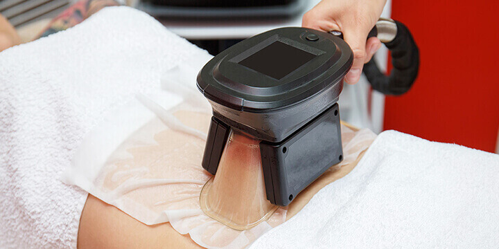 eliminer la cellulite par le froid